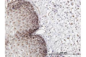 Immunohistochemistry (Formalin-fixed Paraffin-embedded Sections) (IHC (fp)) image for anti-LIM Homeobox 4 (LHX4) (AA 1-390) antibody (ABIN949760)