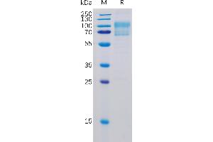 SDS-PAGE (SDS) image for CD80 (CD80) (AA 35-242) protein (mFc-His Tag) (ABIN6964082)