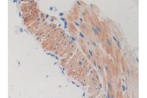 Immunohistochemistry (IHC) image for anti-Torsin Family 1, Member A (Torsin A) (TOR1A) (AA 41-333) antibody (ABIN7443341)