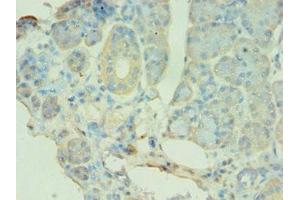 Immunohistochemistry of paraffin-embedded human pancreatic tissue using ABIN7145118 at dilution of 1:100 (ATG9B 抗体  (AA 715-924))