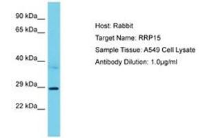 Image no. 1 for anti-Ribosomal RNA Processing 15 Homolog (RRP15) (AA 202-251) antibody (ABIN6750605) (RRP15 抗体  (AA 202-251))