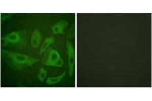 Immunofluorescence analysis of HeLa cells, using FAS (Ab-291) Antibody. (FAS 抗体  (AA 257-306))