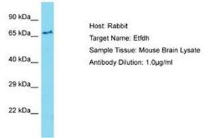 Image no. 1 for anti-Electron-Transferring-Flavoprotein Dehydrogenase (ETFDH) (AA 201-250) antibody (ABIN6750434) (ETFDH 抗体  (AA 201-250))