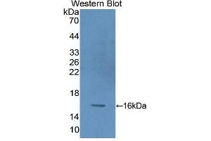 Western blot analysis of recombinant Human PKIg. (PKIG 抗体  (AA 1-76))
