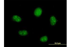 Immunofluorescence of  purified  MaxPab antibody to FTSJ2 on HeLa cell. (FTSJ2 抗体  (AA 1-246))