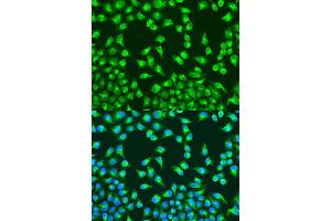 Immunofluorescence analysis of U2OS cells using MT-CO2 antibody (ABIN6294175) at dilution of 1:100. (COX2 抗体)
