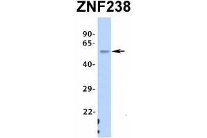 Western Blotting (WB) image for anti-Zinc Finger Protein 238 (ZNF238) (N-Term) antibody (ABIN2776459)