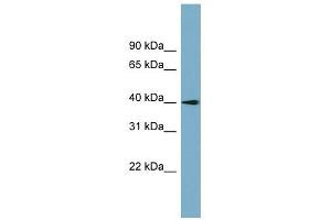 SLC25A22 antibody used at 1 ug/ml to detect target protein. (SLC25A22 抗体)