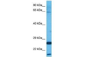 Host:  Rabbit  Target Name:  AMFR  Sample Tissue:  Human HepG2 Whole Cell  Antibody Dilution:  1ug/ml (AMFR 抗体  (C-Term))