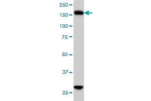 KIF15 monoclonal antibody (M01), clone 4D4 Western Blot analysis of KIF15 expression in HeLa . (KIF15 抗体  (AA 1279-1385))