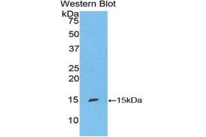 Detection of Recombinant S100A7, Mouse using Polyclonal Antibody to S100 Calcium Binding Protein A7 (S100A7) (S100A7 抗体  (AA 1-108))
