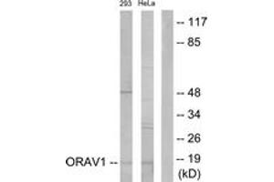Western blot analysis of extracts from 293/HeLa cells, using ORAV1 Antibody. (ORAOV1 抗体  (AA 81-130))