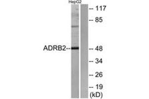 Western blot analysis of extracts from HepG2 cells, using ADRB2 Antibody. (beta 2 Adrenergic Receptor 抗体  (AA 336-385))