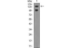 Western blot analysis using FBXL10 mouse mAb against A549 (1) cell lysate.