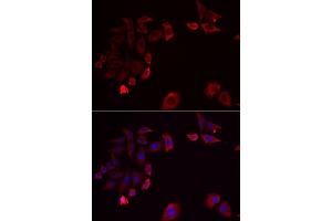 Immunofluorescence analysis of HeLa cells using SK antibody . (SKAP2 抗体  (AA 1-120))