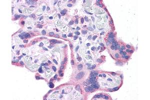 Immunohistochemistry (IHC) image for anti-Wilms Tumor 1 (WT1) (Middle Region) antibody (ABIN2780340) (WT1 抗体  (Middle Region))