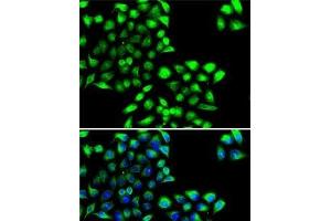 Immunofluorescence analysis of MCF7 cells using COPS6 Polyclonal Antibody (COPS6 抗体)