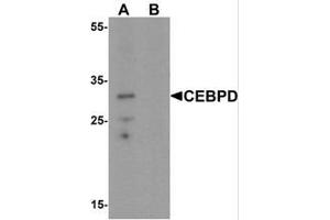 Western blot analysis of CEBPD in rat spleen tissue lysate with CEBPD Antibody  at 0. (CEBPD 抗体  (C-Term))