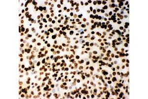 Immunohistochemistry (IHC) image for anti-Minichromosome Maintenance Complex Component 2 (MCM2) (AA 884-904), (C-Term) antibody (ABIN3044274)