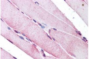 Human Skeletal Muscle: Formalin-Fixed, Paraffin-Embedded (FFPE) (SEPN1 抗体  (C-Term))
