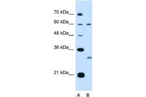 Western Blotting (WB) image for anti-Tetraspanin 32 (TSPAN32) antibody (ABIN2462993) (TSPAN32 抗体)