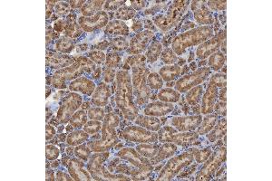IHC analysis of SEC31A using anti-SEC31A antibody (ABIN7599630).