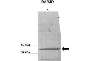 WB Suggested Anti-RAB3D Antibody    Positive Control:  Lane 1: BCAM0379 protein from B cenocepacia  Primary Antibody Dilution :   1:5000  Secondary Antibody :  Anti-rabbit-HRP   Secondry Antibody Dilution :   1:5000  Submitted by:  Katie Nurse (RAB3D 抗体  (C-Term))