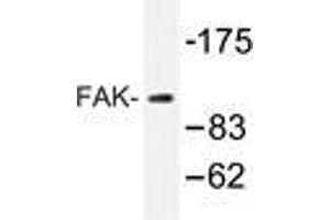 Western blot analysis of FAK antibody in extracts from 293 cells. (FAK 抗体)