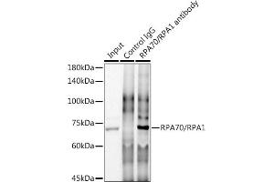 Immunoprecipitation analysis of 300 μg extracts of HeLa cells using 3 μg RP/RP antibody (ABIN7269915). (RPA1 抗体)