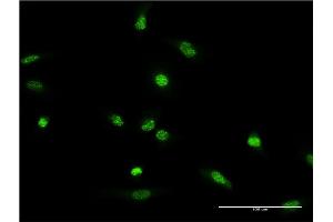 Immunofluorescence of monoclonal antibody to XRCC2 on HeLa cell.