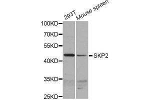 Western blot analysis of extracts of various cell lines, using SKP2 antibody (ABIN1874793) at 1:1000 dilution. (SKP2 抗体)