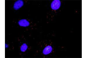 Proximity Ligation Analysis of protein-protein interactions between RHOA and DAAM1. (RHOA 抗体  (AA 1-193))
