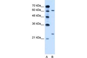 Western Blotting (WB) image for anti-RAR-Related Orphan Receptor A (RORA) antibody (ABIN2462863) (RORA 抗体)