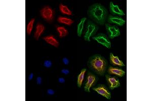 ABIN6262909 and ABIN6273260 staining Hela cells by IF/ICC. (LAPTM4B 抗体  (Internal Region))