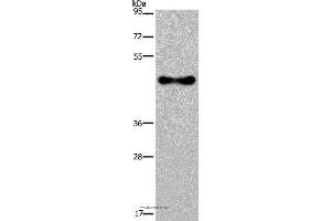 Western blot analysis of Human fetal brain tissue, using FADS1 Polyclonal Antibody at dilution of 1:300 (FADS1 抗体)