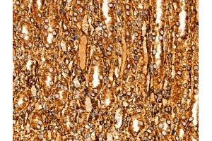 Phospho-PHD2 (Ser125) Antibody at 1/100 staining Rat kidney tissue by IHC-P.