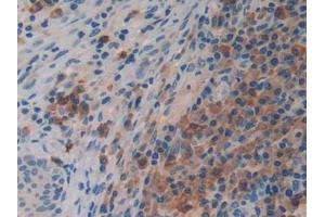 Immunohistochemistry (IHC) image for anti-Protease, serine, 2 (Trypsin 2) (PRSS2) (AA 24-241) antibody (ABIN7433747)