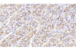 Detection of GDF5 in Human Stomach Tissue using Polyclonal Antibody to Growth Differentiation Factor 5 (GDF5) (GDF5 抗体  (AA 382-501))
