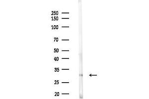 Western blot analysis of lysates from Rat kidney, using OR2M4 Antibody at 1/1000 dilution.
