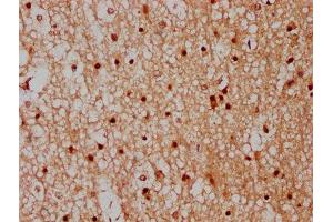 IHC image of ABIN7148527 diluted at 1:300 and staining in paraffin-embedded human brain tissue performed on a Leica BondTM system. (CPNE7 抗体  (AA 254-393))