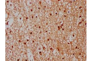IHC image of ABIN7148527 diluted at 1:300 and staining in paraffin-embedded human brain tissue performed on a Leica BondTM system. (CPNE7 抗体  (AA 254-393))