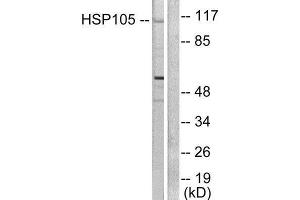 Western Blotting (WB) image for anti-Heat Shock 105kDa/110kDa Protein 1 (HSPH1) (C-Term) antibody (ABIN1848610) (HSPH1 抗体  (C-Term))