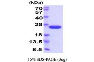 SDS-PAGE (SDS) image for Cyclophilin B (PPIB) (AA 34-216) (Active) protein (His tag) (ABIN6388040)