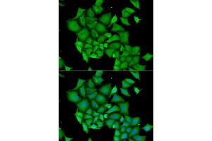 Immunofluorescence analysis of HeLa cells using DFFA antibody. (DFFA 抗体)