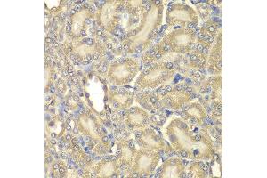 Immunohistochemistry of paraffin-embedded rat kidney using MBP antibody at dilution of 1:200 (400x lens). (MBP 抗体)