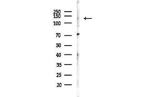 Western blot analysis of lysates from Rat brain, using EPH Antibody at 1/1000 dilution.