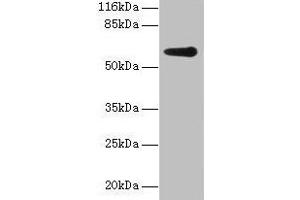 Western blot All lanes: GK2 antibody at 2 μg/mL + Jurkat whole cell lysate Secondary Goat polyclonal to rabbit IgG at 1/10000 dilution Predicted band size: 61 kDa Observed band size: 61 kDa (GK2 抗体  (AA 2-553))