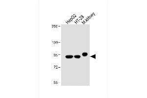 All lanes : Anti-Villin-1 Antibody (N-term) at 1:2000 dilution Lane 1: HepG2 whole cell lysate Lane 2: HT-29 whole cell lysate Lane 3: Mouse kidney lysate Lysates/proteins at 20 μg per lane. (Villin 1 抗体  (N-Term))