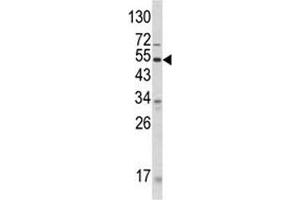 Western blot analysis of ANGPTL3 antibody and human CEM lysate. (ANGPTL3 抗体  (AA 82-114))