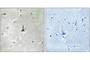 Immunohistochemistry analysis of paraffin-embedded human brain tissue, using LRP10 Antibody. (LRP10 抗体  (AA 204-253))